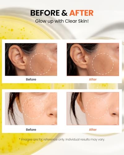KSECRET - SEOUL 1988 Glow Serum: Niacinamide 15% + Yuja - 30ml